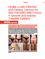 Finally, a Safe, Effective and Painless Solution for Skin Flaccidity with Fotona V-Smooth and Robotic T-Runner Delivery